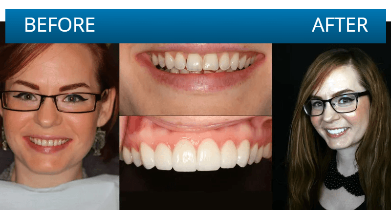 Before and after dental treatment result