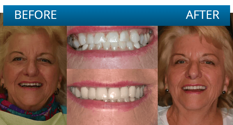 Before and after dental treatment result
