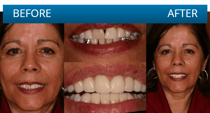 Before and after dental treatment result