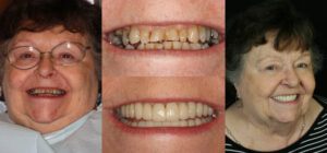 Before and after smile transformation — case 129, J. Ladd Williams Cosmetic Dentistry, Mesa AZ