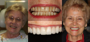 Before and after smile transformation — case 104, J. Ladd Williams Cosmetic Dentistry, Mesa AZ