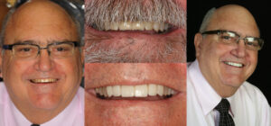Before and after smile transformation — case 87, J. Ladd Williams Cosmetic Dentistry, Mesa AZ