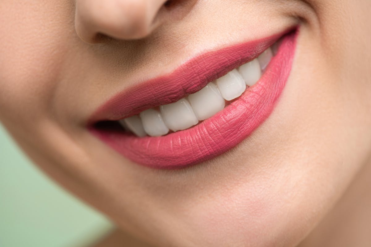 Beautiful smile with porcelain veneers at J. Ladd Williams Cosmetic Dentistry in Mesa, AZ